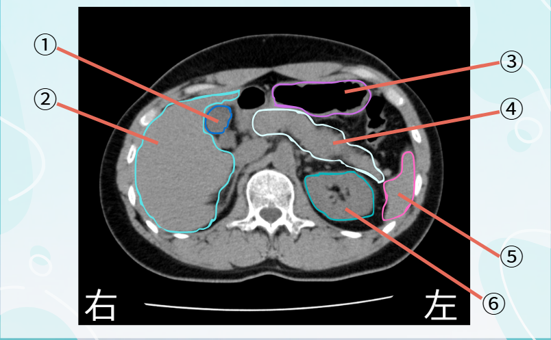 CT画像　クイズ