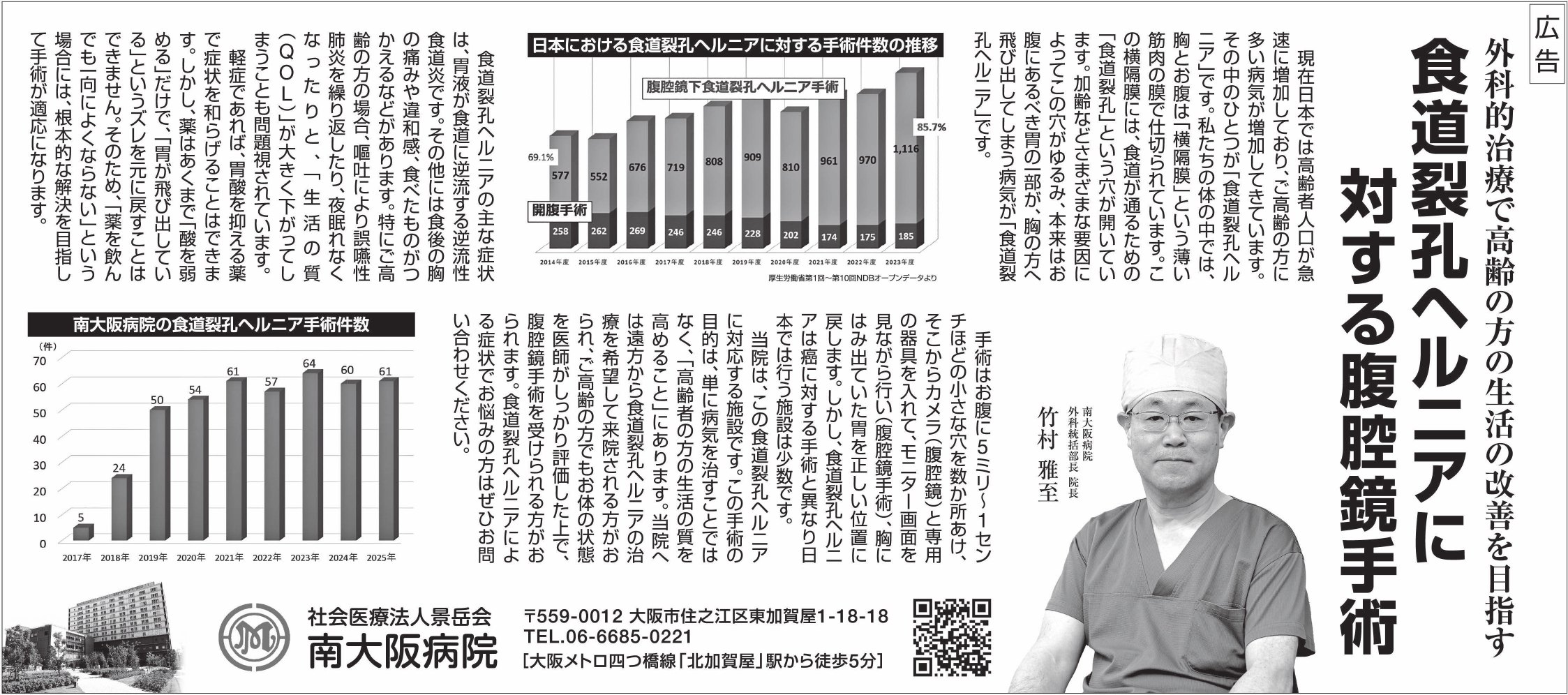 医師ページ 毎日新聞朝刊 大阪府内版に「食道裂孔ヘルニア対する腹腔鏡手術