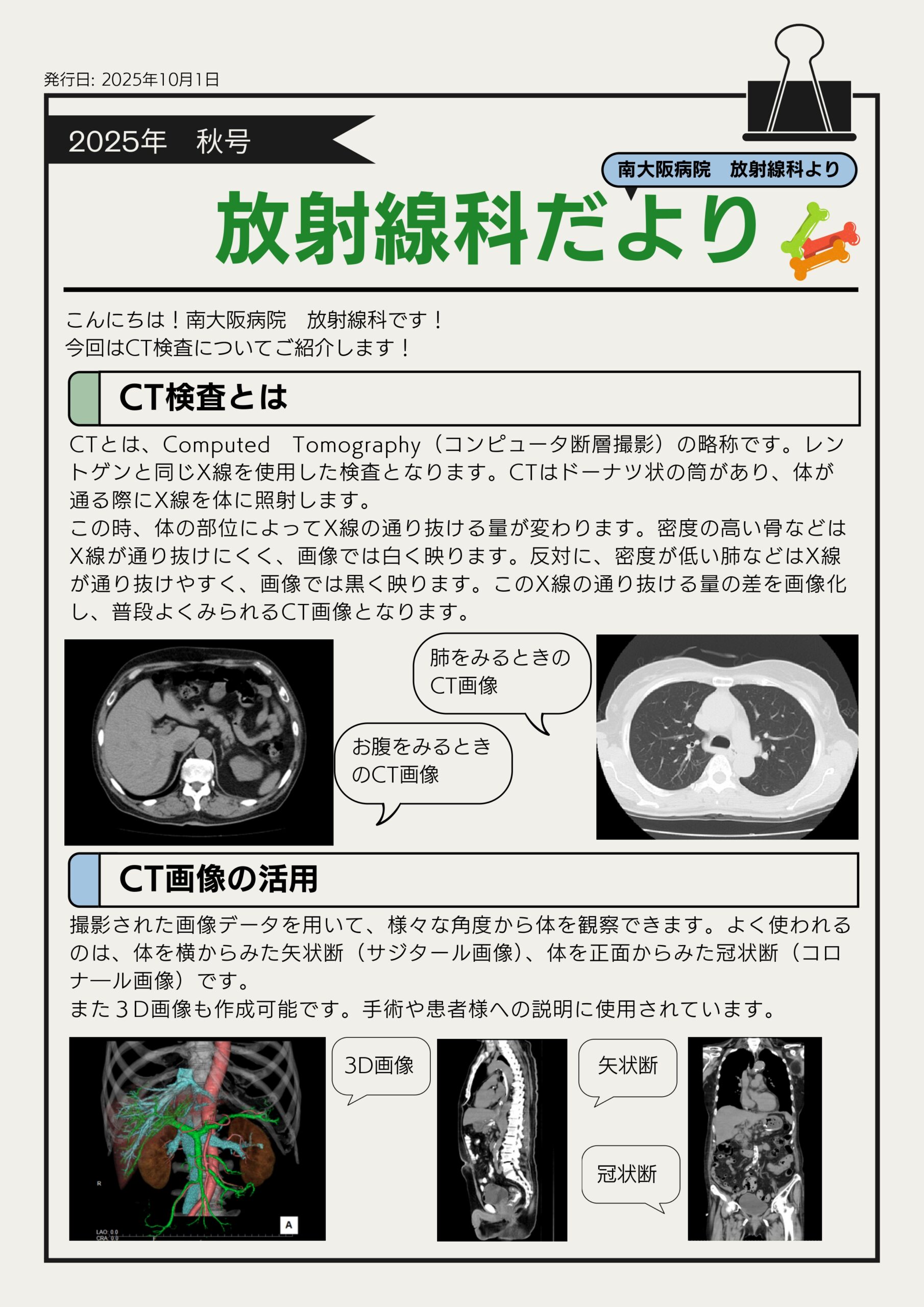 CT検査について